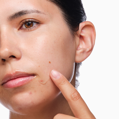 THE ORDINARY - THE ACNE SET