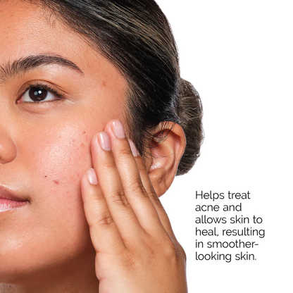 THE ORDINARY - THE ACNE SET