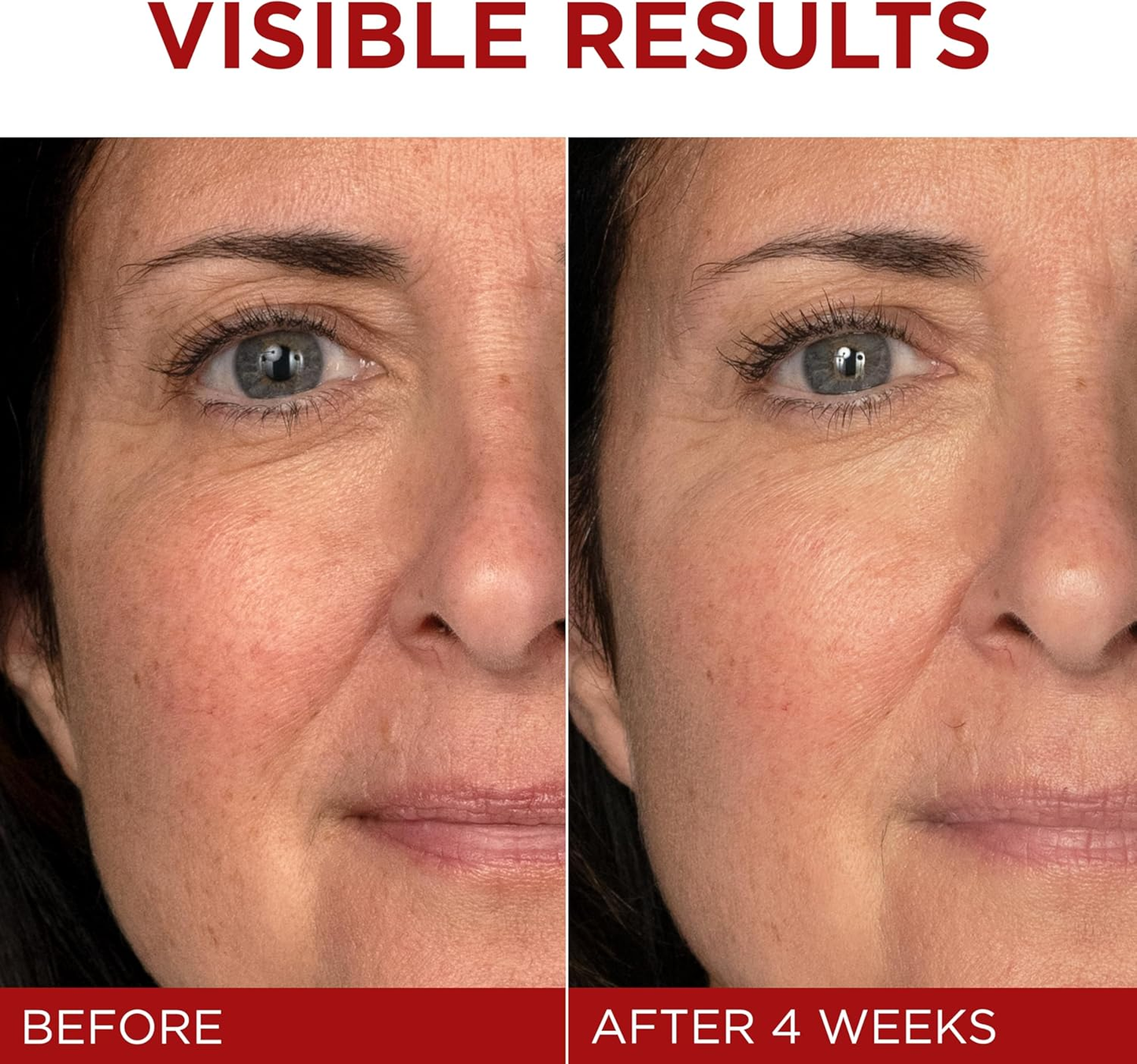 LOREAL - REVITALIFT TRIPLE POWER ANTI-AGING MOISTURIZER