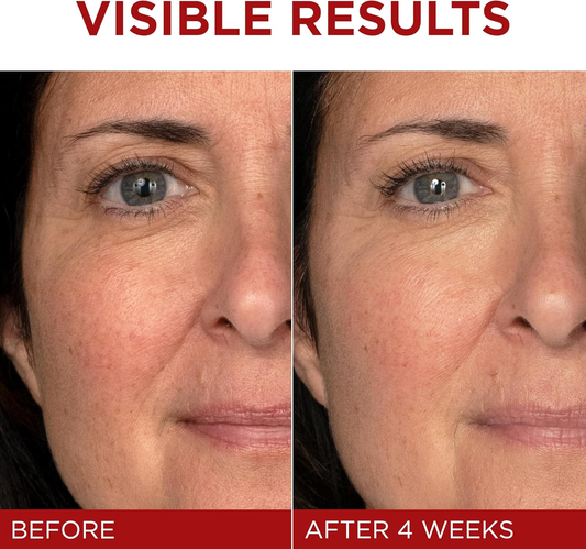 LOREAL - REVITALIFT TRIPLE POWER ANTI-AGING MOISTURIZER